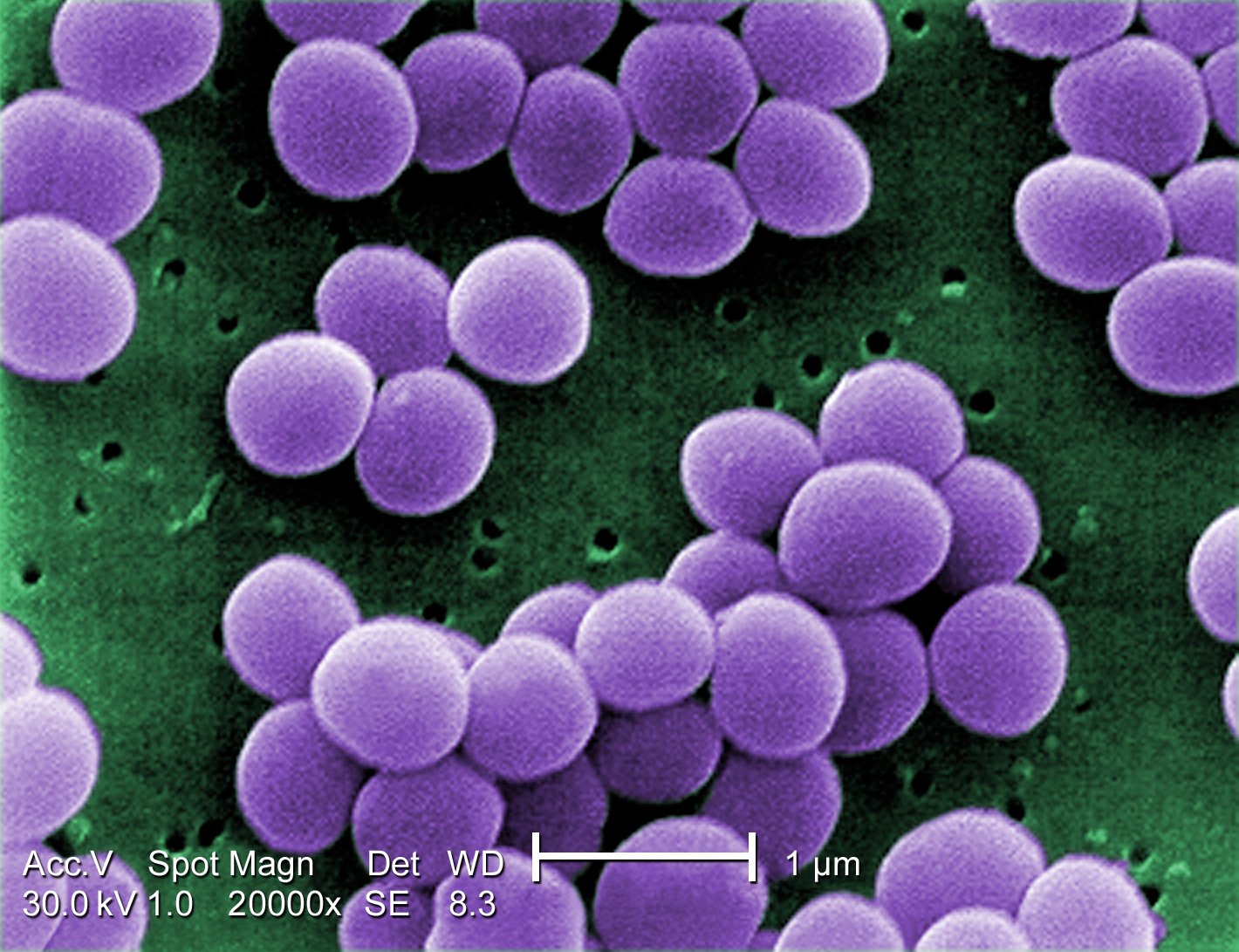 images/Staphylococcus aureus.jpg